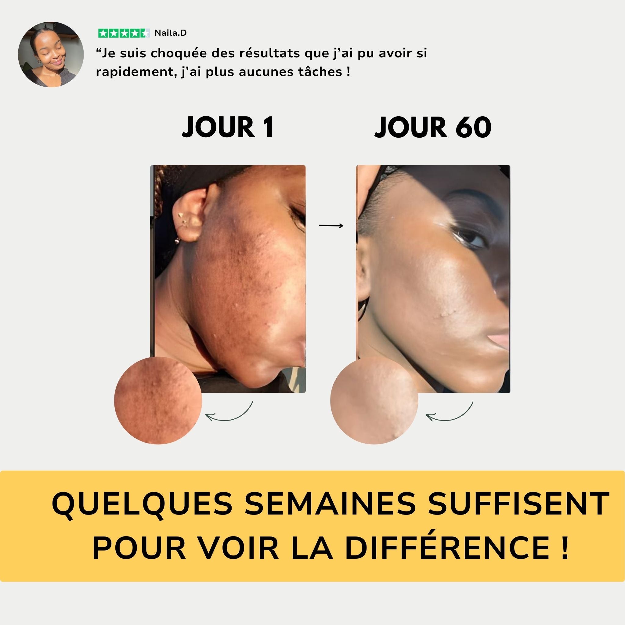 Pads Nettoyant Au Curcuma